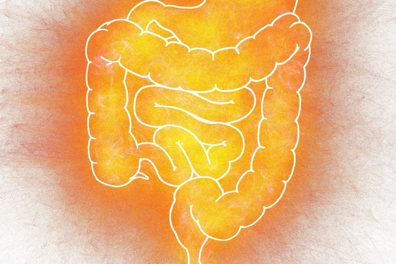Illustration of human intestine, the difference between UC and Crohns